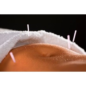 Imagem do produto Clínica de Medicina Chinesa, Acupuntura e Estética Natural em Lisboa 6