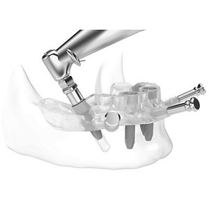Imagem do produto Mude o seu sorriso de um dia para o outro 3